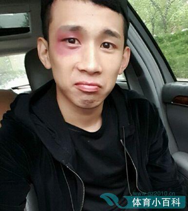 八卦爆料天佑视频播放,天佑视频播放背后的惊人真相